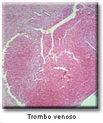 lung035