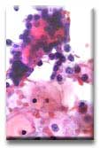pap40x2