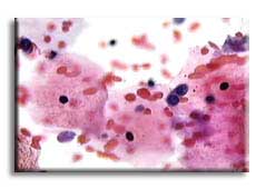 pap40x3